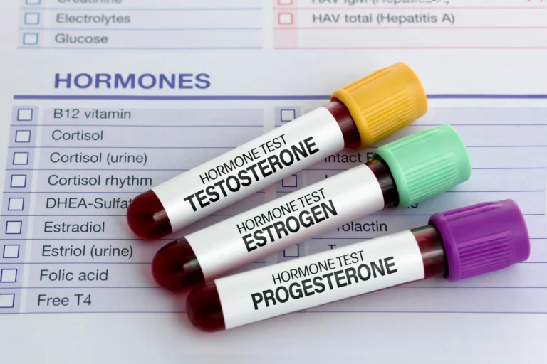Sex hormones. Three labeled blood samples for hormone tests—testosterone, estrogen, and progesterone—placed on a medical form listing various hormone and vitamin tests.